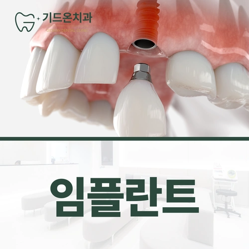 기드온치과의 임플란트 진료 주제를 담은 사용자 제공 이미지