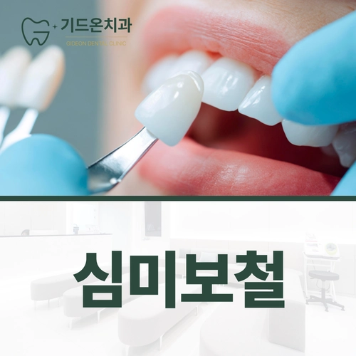 기드온치과의 심미보철 진료 주제를 담은 사용자 제공 이미지